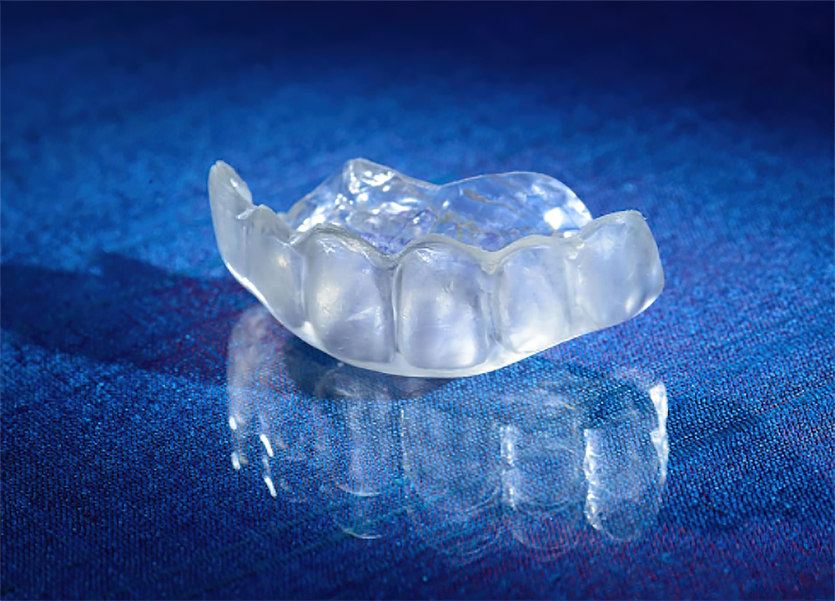 BiteSoft Splints: A Solution for Tooth Grinders and Clenchers - Burbank Dental Lab - Los Angeles - Burbank