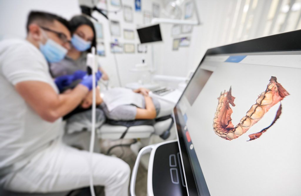 Intraoral Scanning: Steps for Improving Digital Implant Scans - Burbank Dental Lab - Burbank - Los Angeles