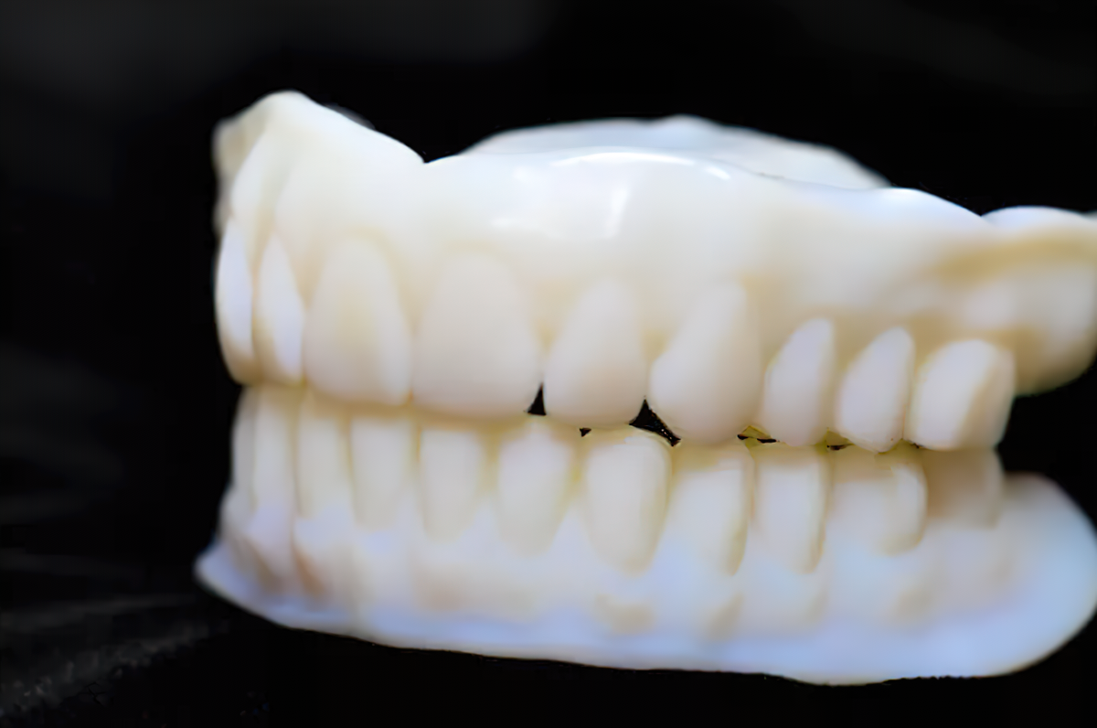 Ivoclar Digital Dentures System - Digital Denture Workflow