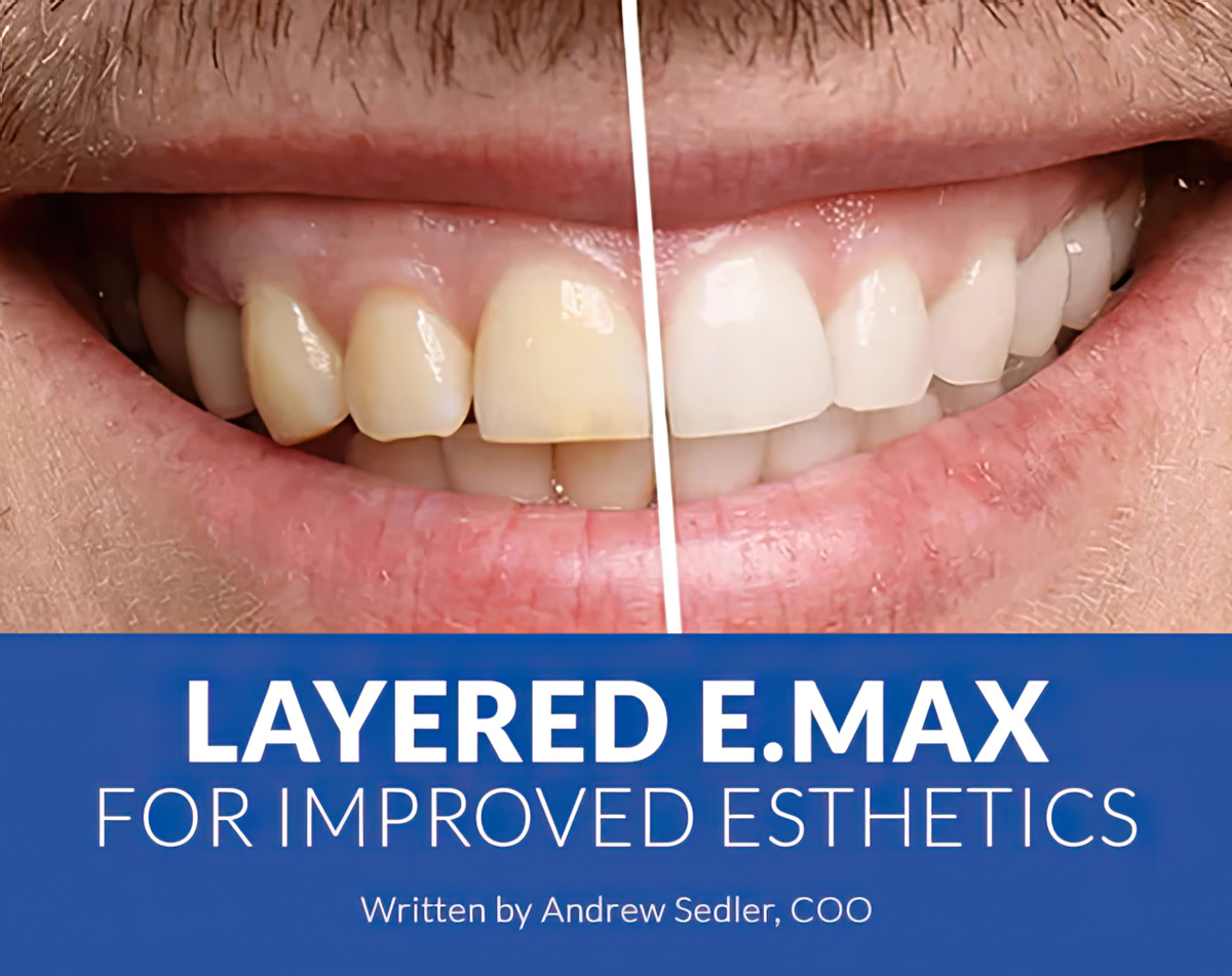 Layered E.Max for Improved Esthetics - Burbank Dental Lab - A California Dental Lab