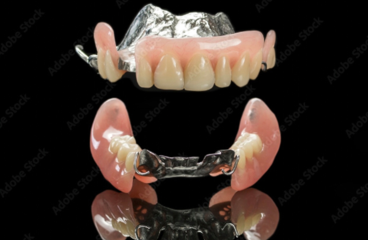 Partial dentures - Burbank Dental Lab - California dental lab