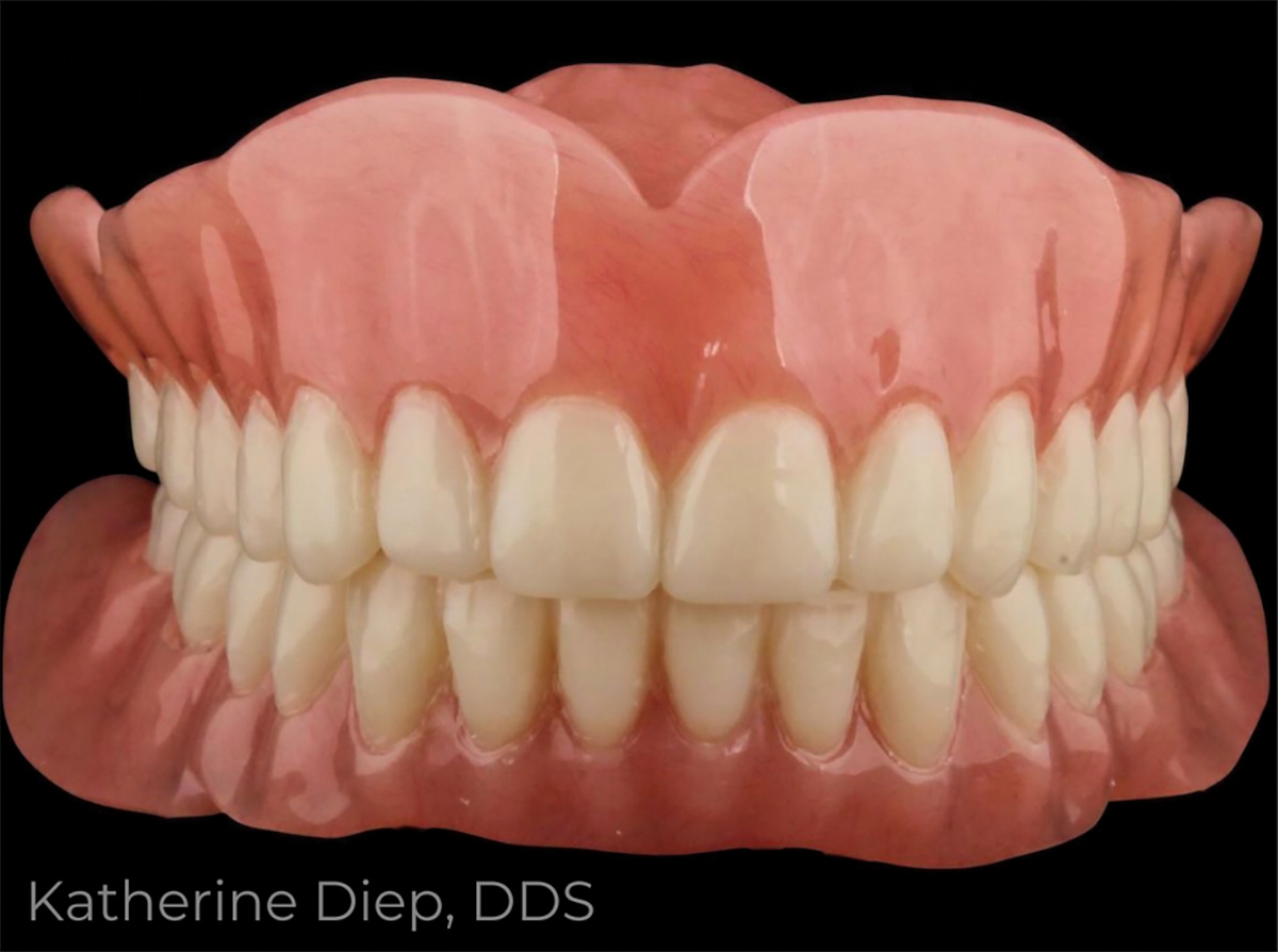 The Benefits of Digital Denture Workflows - Burbank Dental Lab - Burbank, CA