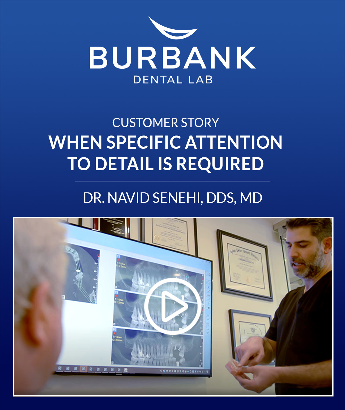 When specific attention to detail is required - Dr. Navid Senehi, DDS, MD - FOSI (Facial & Oral Surgery Institute) - Burbank Dental Lab