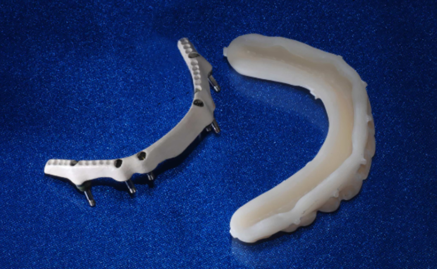 Elevating the Paradigm of Dental Restorations with SmartComposite Hybrids - Burbank Dental Lab