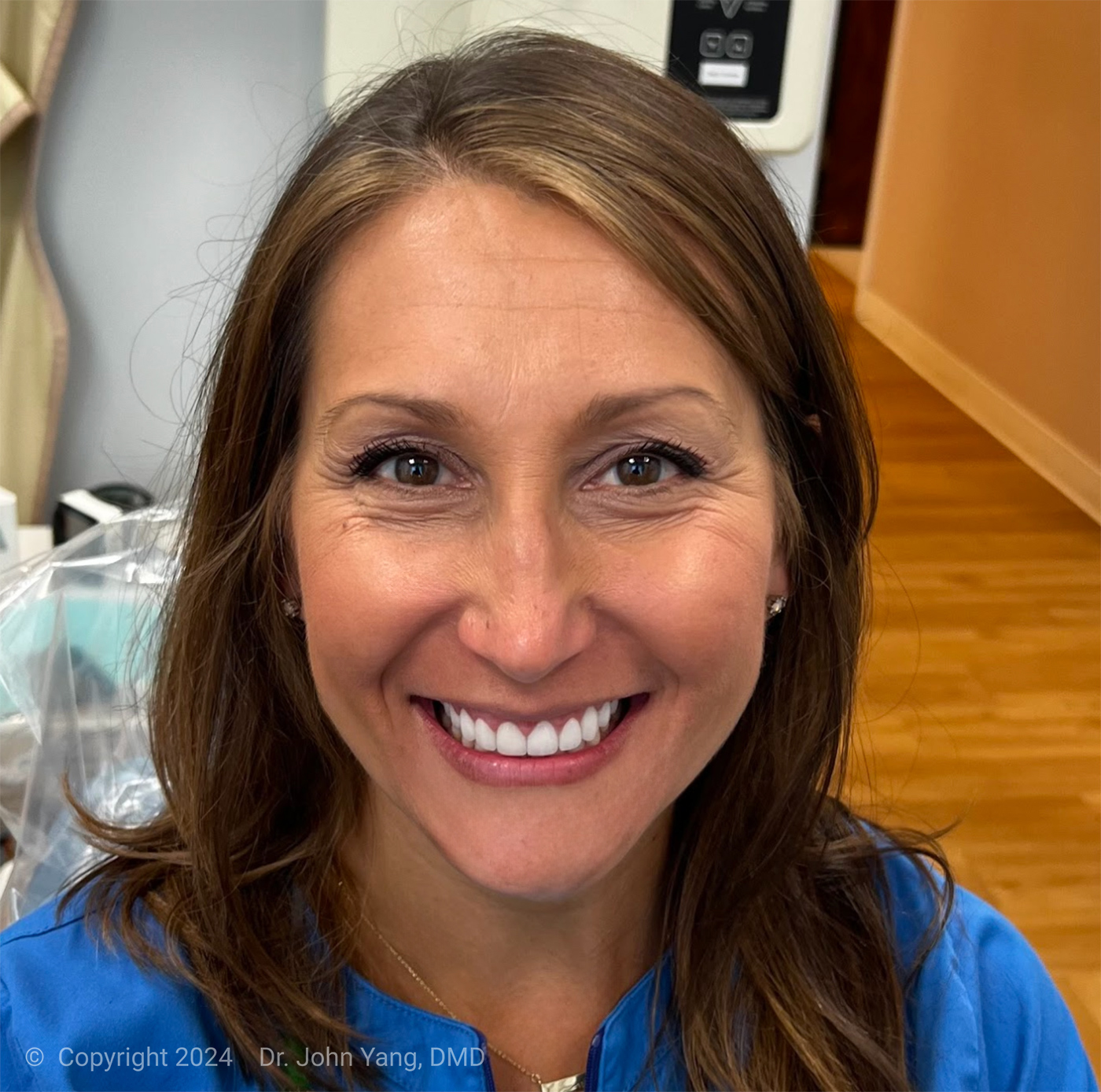 Smile Transformation - Dr. John Yang - Tru Family Dental and Burbank Dental Lab - California