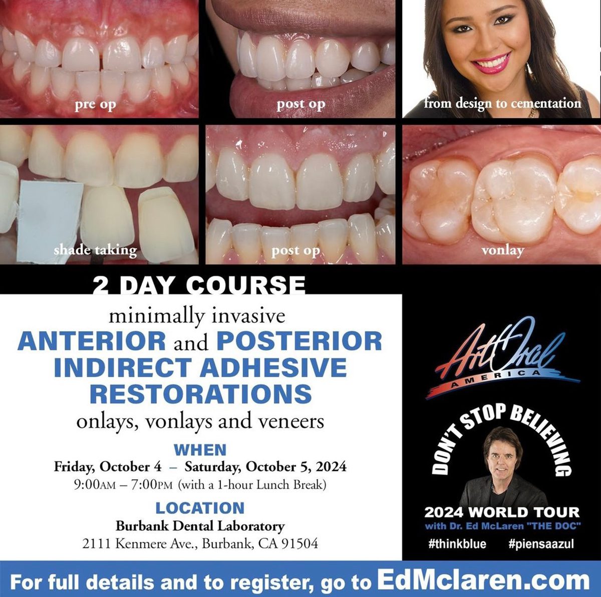 Minimally Invasive Indirect Adhesive Restorations: Inlays, Onlays, and Veneers - Burbank Dental Lab - Dr. Ed McLaren Course