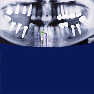 Video - Burbank Dental Lab