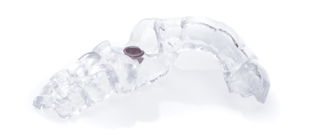 SMART 1 screw-retained