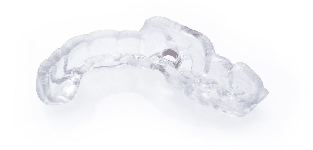 SMART 1 screw-retained