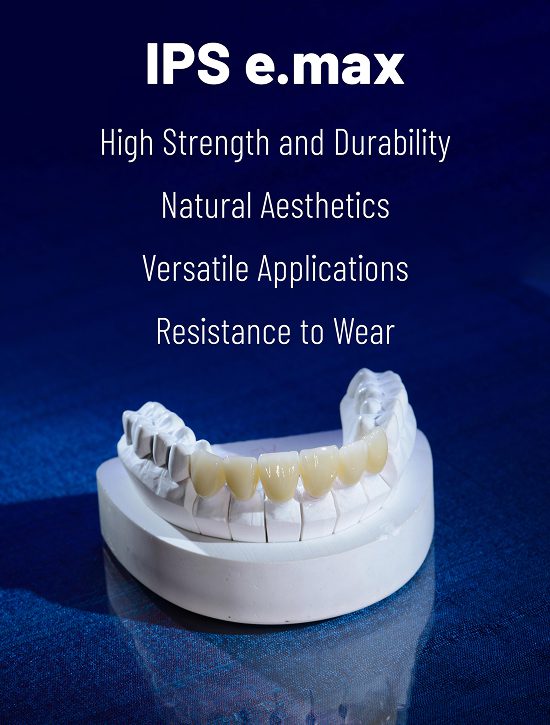 IPS e.max - High Strength and Durability, Natural Aesthetics, Versatile Applications, Resistance to Wear - Burbank Dental Lab
