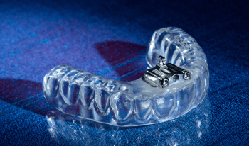 TAP 3 Appliance - Burbank Dental Lab