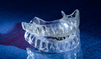 TAP 3 Appliance - Burbank Dental Lab