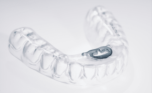 TAP 3 Appliance - Burbank Dental Lab