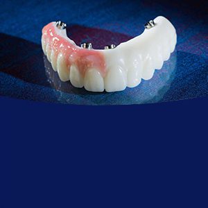 PMMA Provisional - DURATEMP