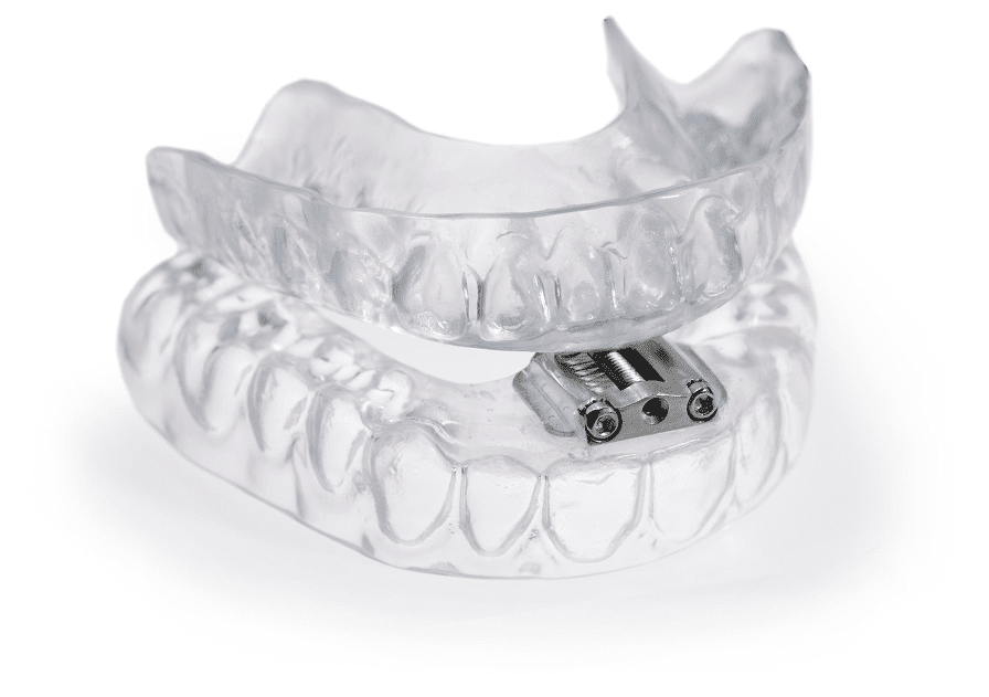 TAP 3 Appliance - Burbank Dental Lab