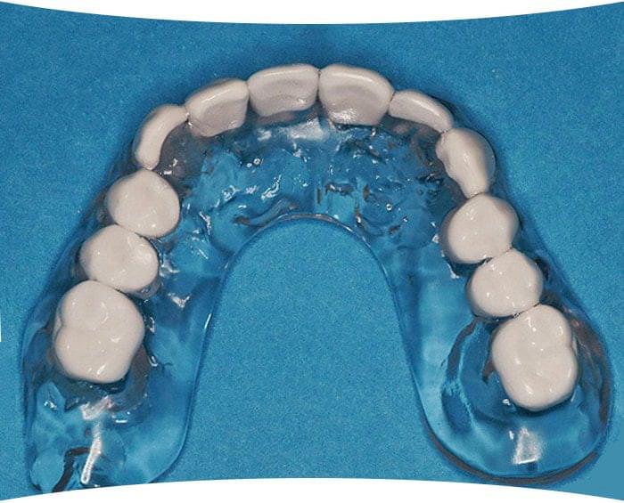 Radiographic Scanning Guides