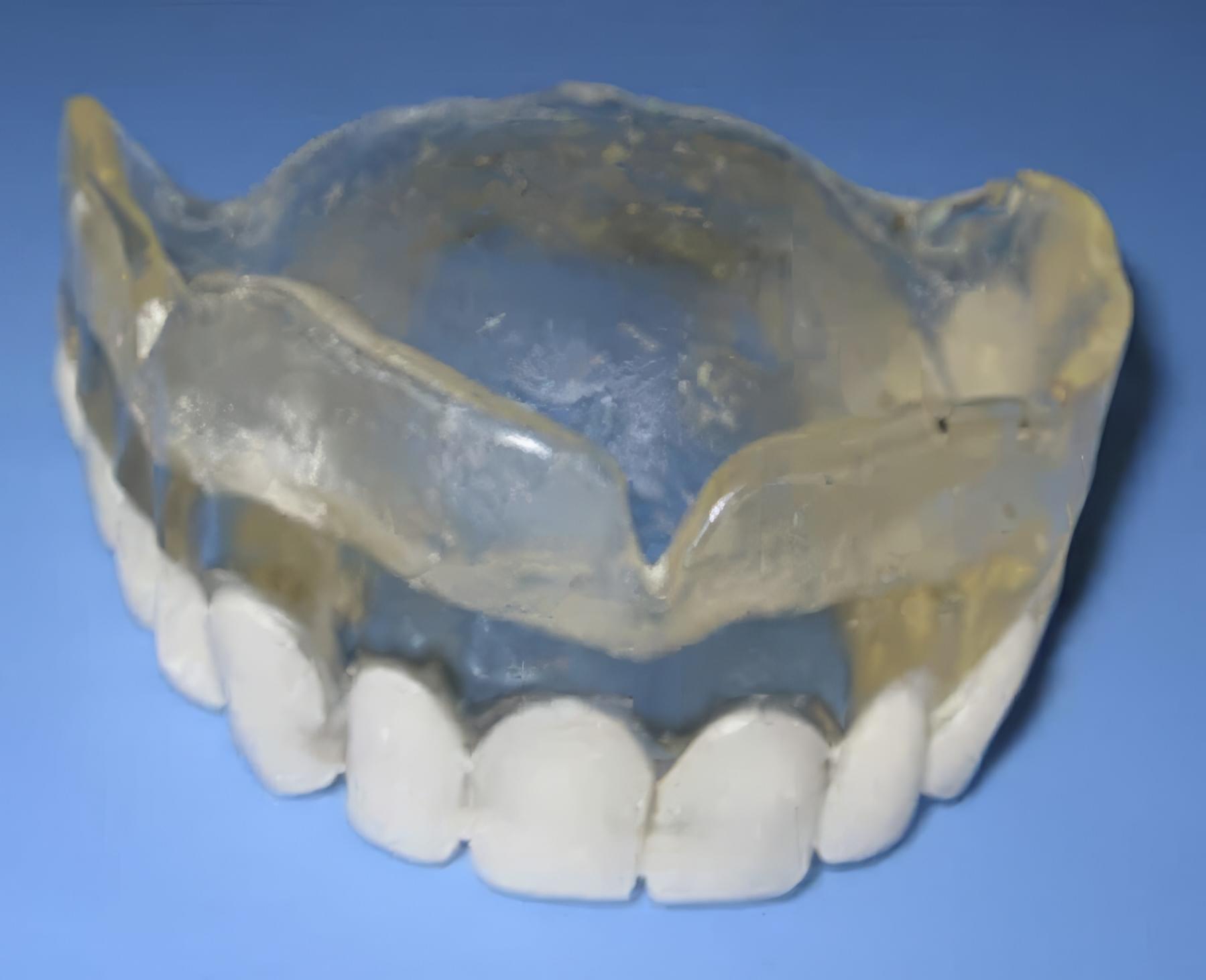 Step-By-Step Digital Workflow for Edentulous Implant Cases | Burbank Dental Lab