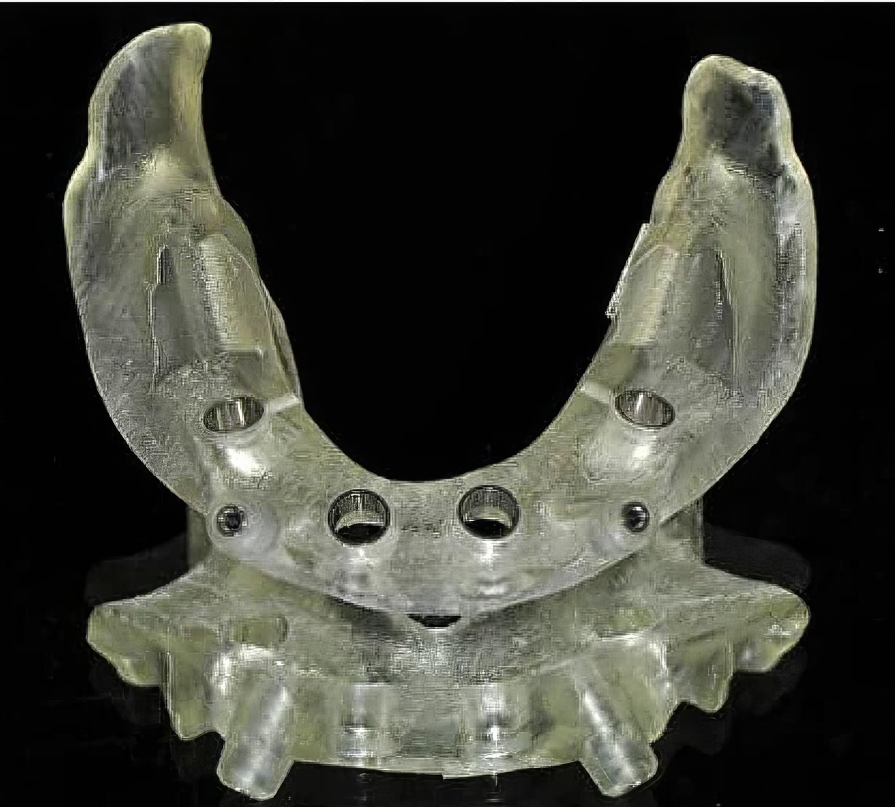 Step-By-Step Digital Workflow for Edentulous Implant Cases | Burbank Dental Lab