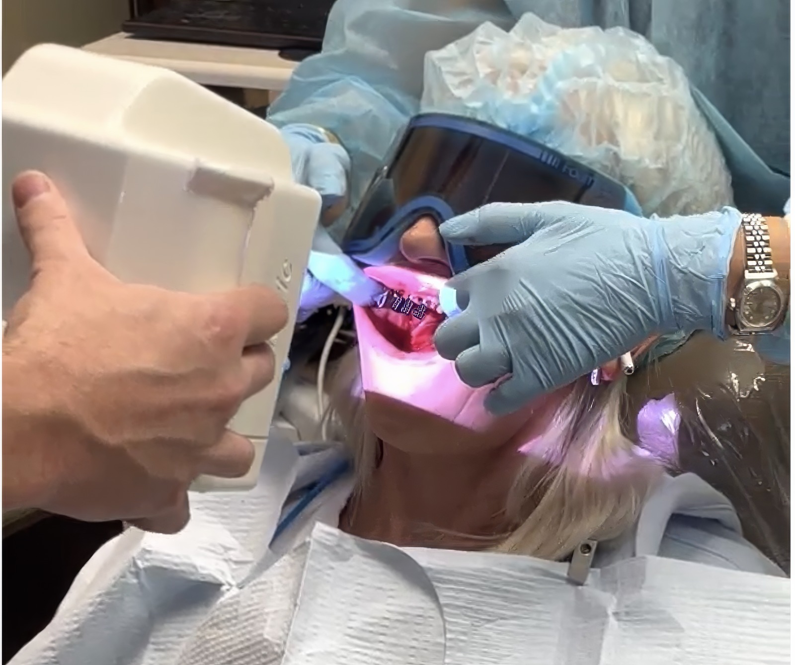All-Digital Full Arch Restorations with ICam4D: Burbank Dental Lab Leads the Way  |  by Andrew Sedler