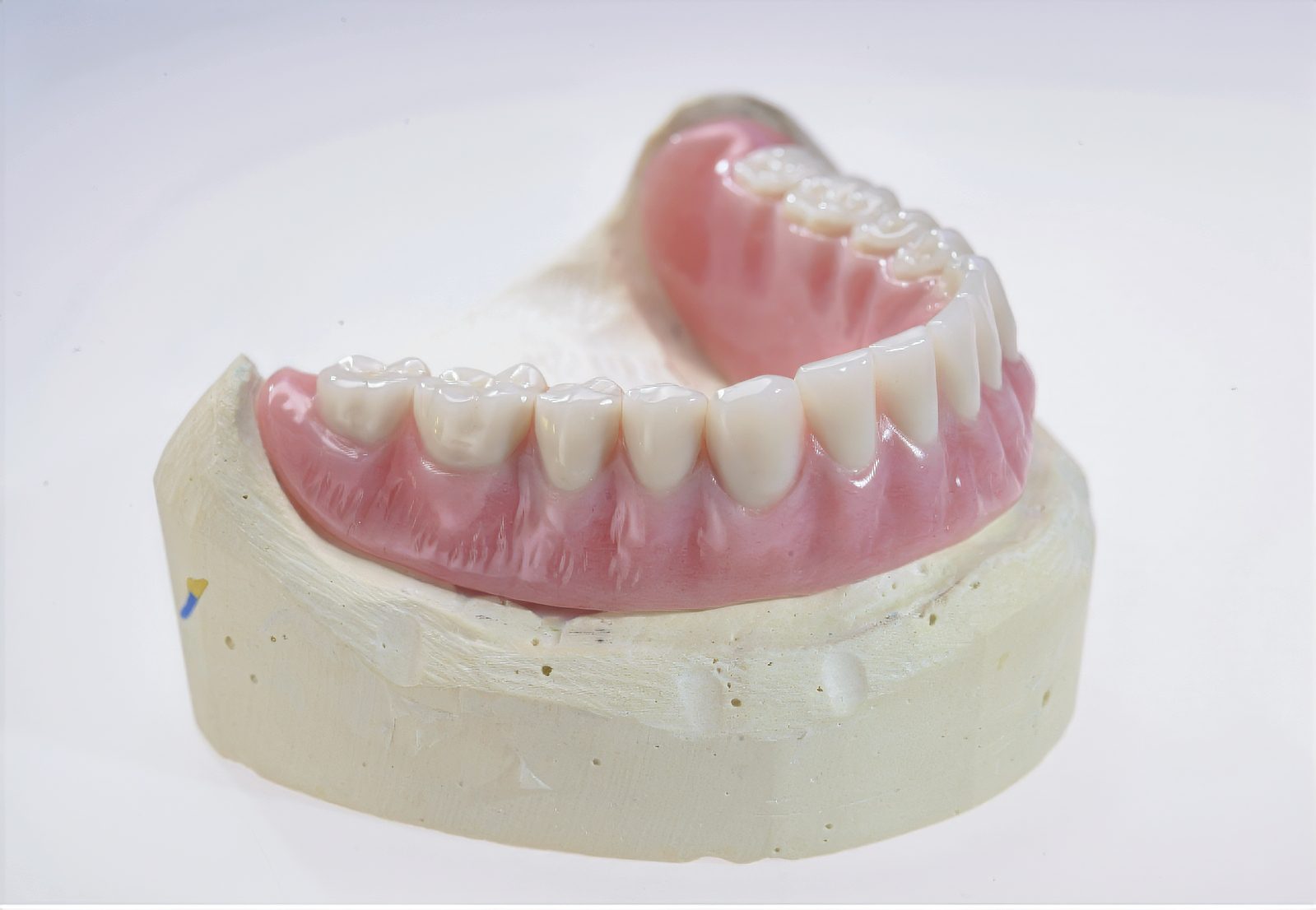 Choosing the Right Full-Arch Implant Restoration: Hybrid, Zirconia or Acrylic - by Andrew Sedler - Burbank Dental Lab - CA