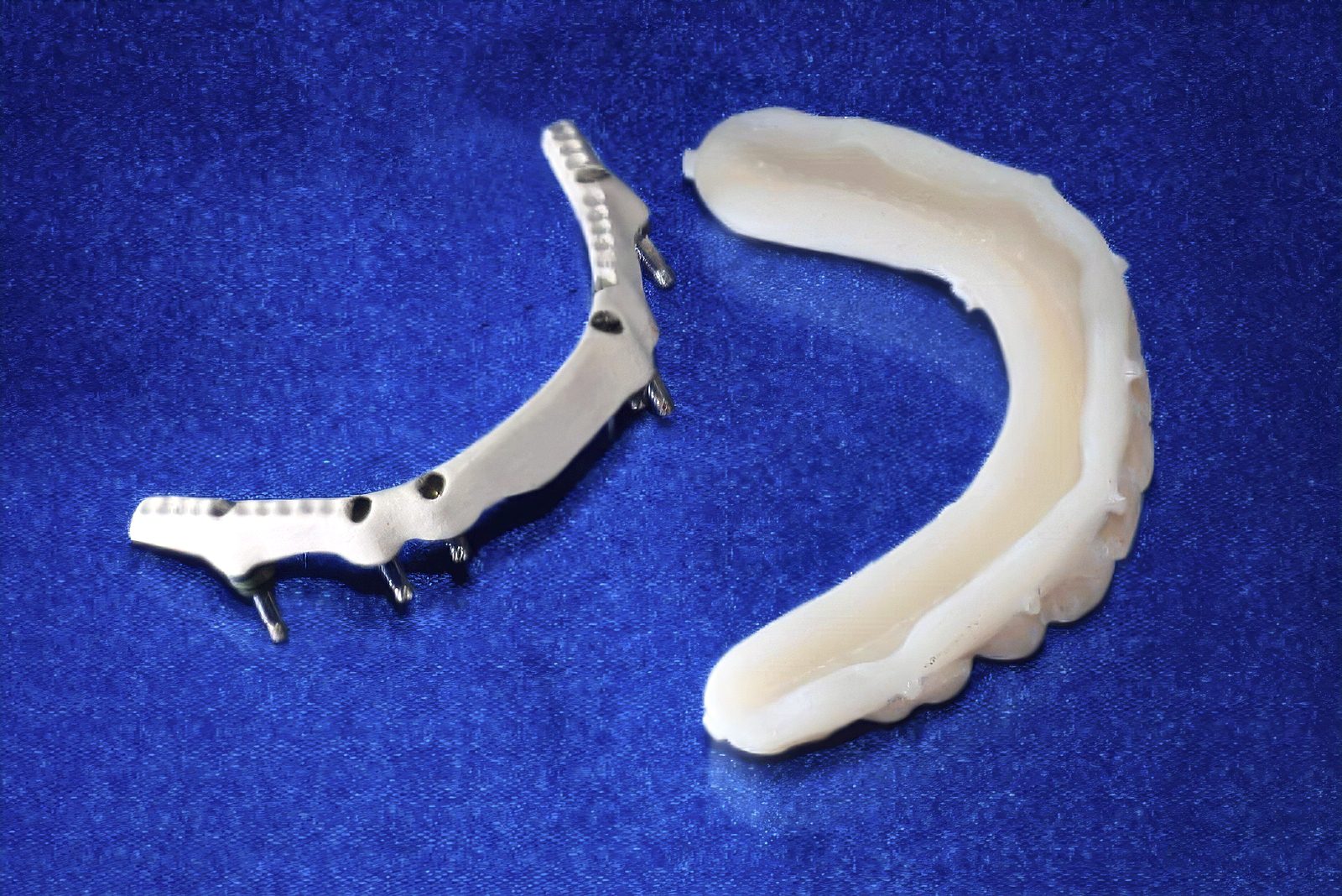 Choosing the Right Full-Arch Implant Restoration: Hybrid, Zirconia or Acrylic - by Andrew Sedler - Burbank Dental Lab - CA
