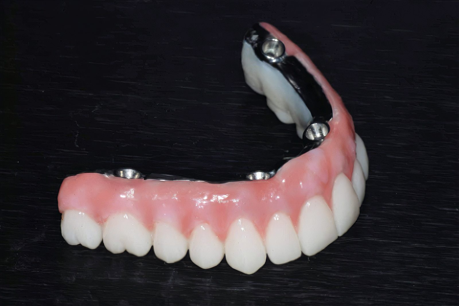 Choosing the Right Full-Arch Implant Restoration: Hybrid, Zirconia or Acrylic - by Andrew Sedler - Burbank Dental Lab - CA