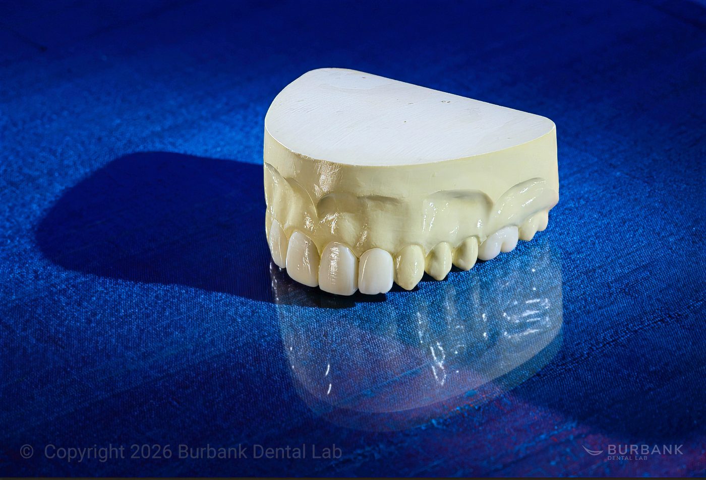 Diagnostic Wax-Ups /  Burbank Dental Lab