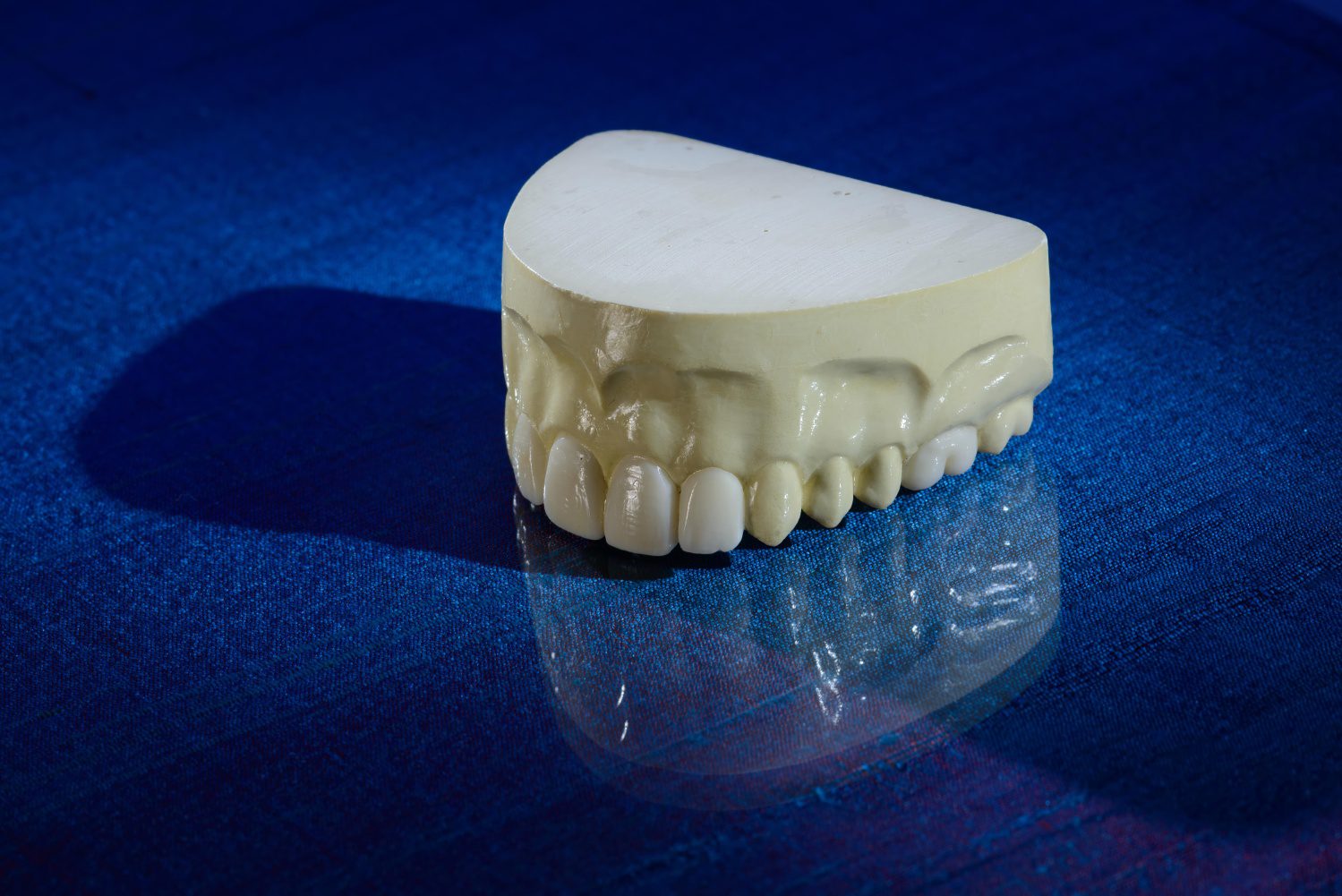 Diagnostic Wax-ups, A Burbank Dental Lab product in our Esthetic All-Ceramic category of Products - Burbank Dental Lab - CA