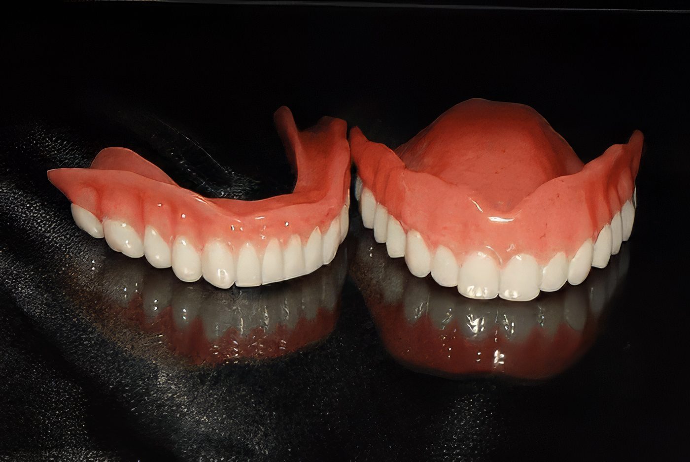 Ivoclar Digital Denture - Burbank Dental Lab - CA