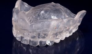 Step-By-Step Digital Workflow for Edentulous Implant Cases | Burbank Dental Lab