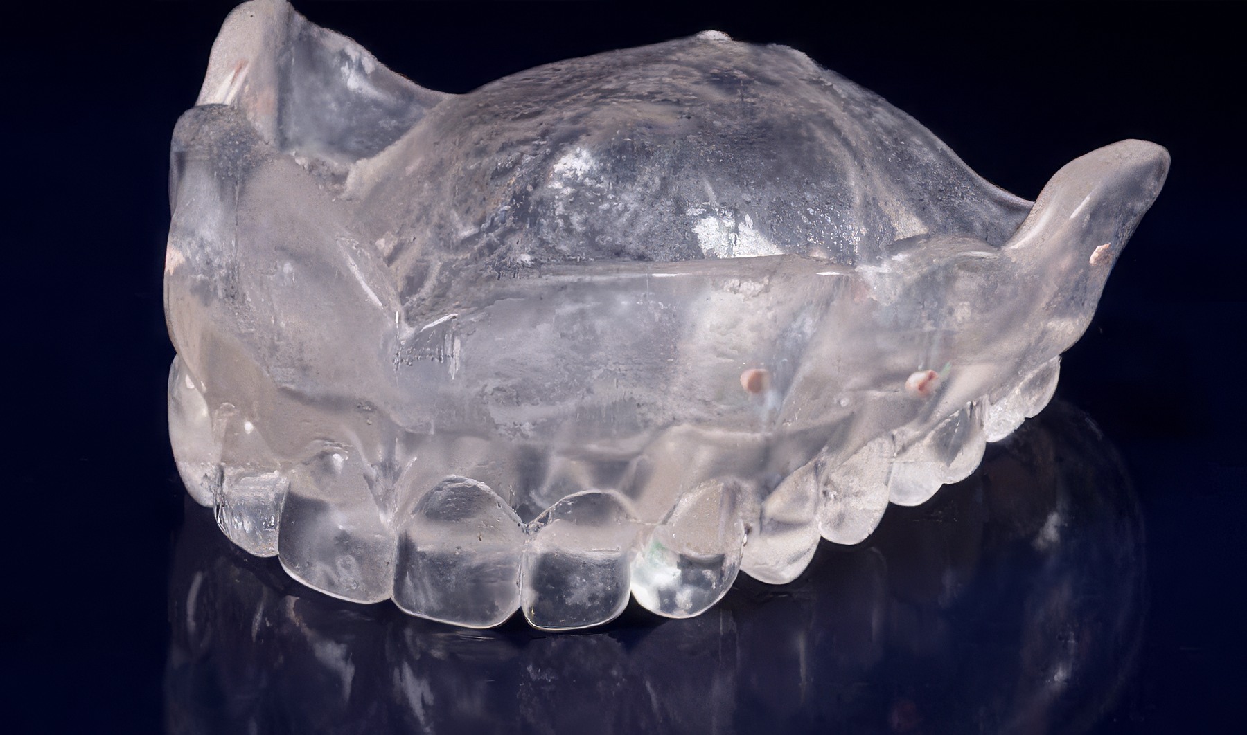 Step-By-Step Digital Workflow for Edentulous Implant Cases | Burbank Dental Lab
