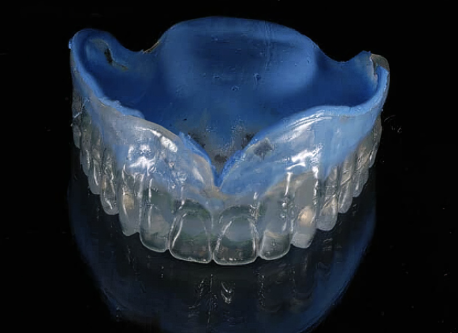 Step-By-Step Digital Workflow for Edentulous Implant Cases | Burbank Dental Lab