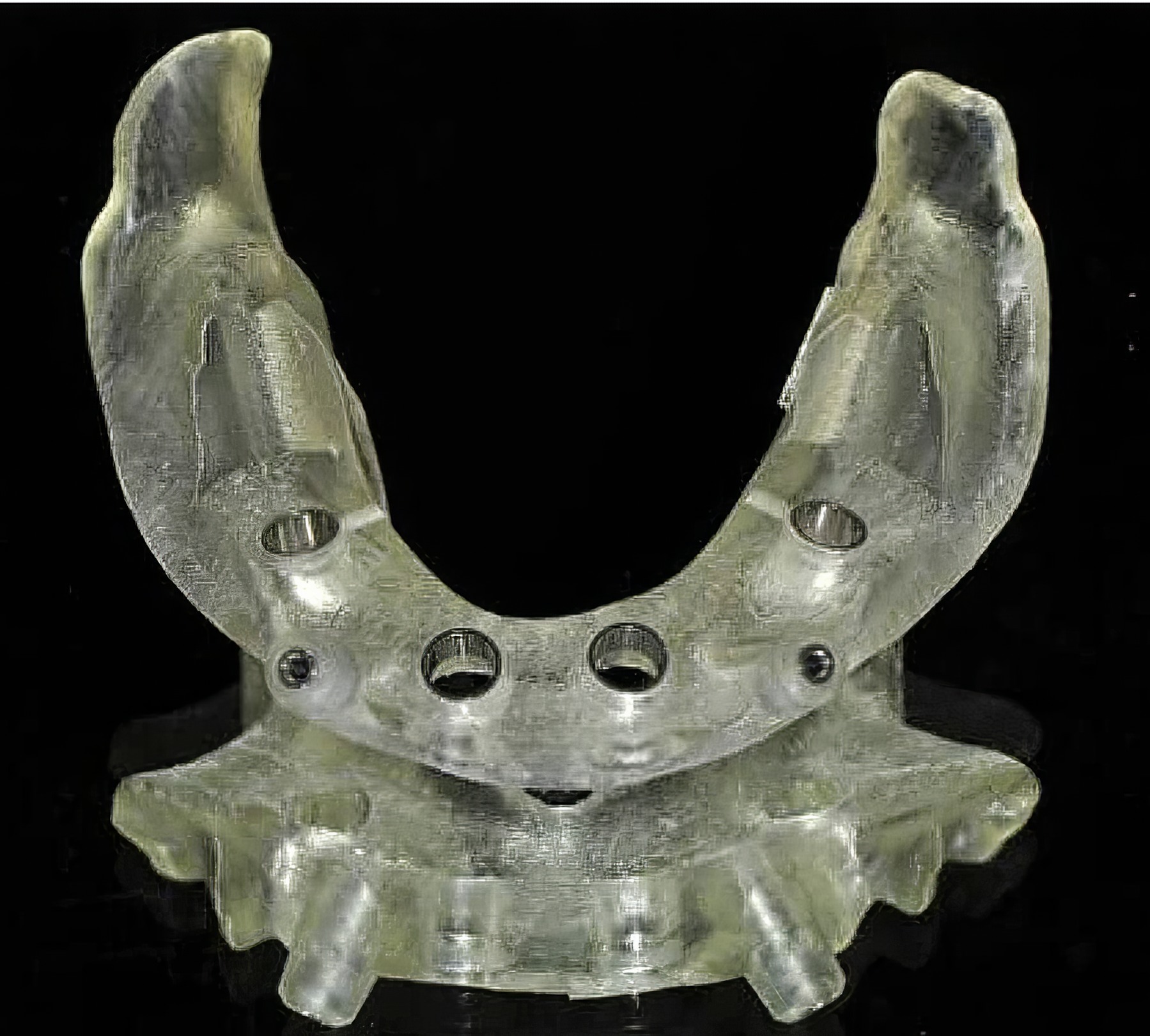 Step-By-Step Digital Workflow for Edentulous Implant Cases | Burbank Dental Lab