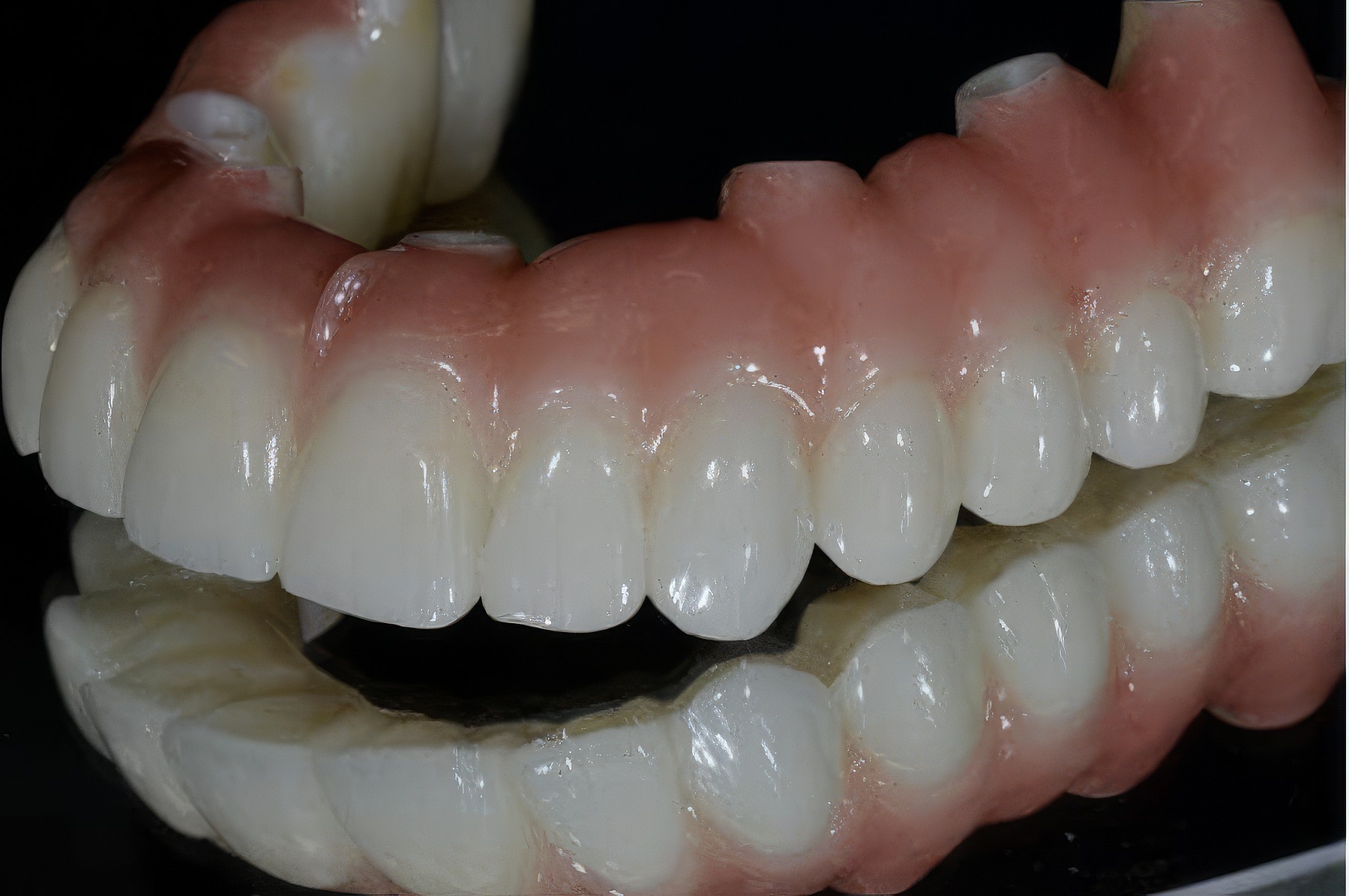 Step-By-Step Digital Workflow for Edentulous Implant Cases | Burbank Dental Lab