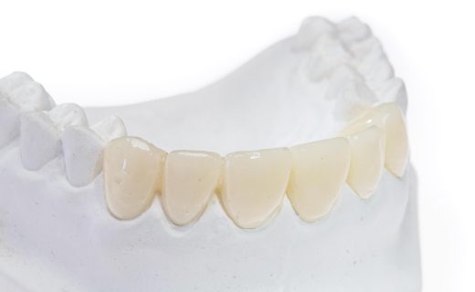 DuraTemp Provisional Restorations - Product - Burbank Dental Lab