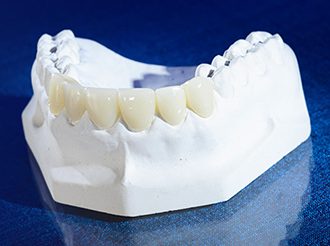 DuraTemp Provisional Restorations - Product - Burbank Dental Lab