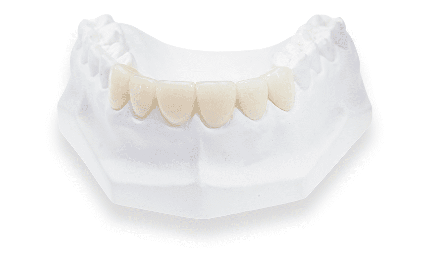 DuraTemp Provisional Restorations - Product - Burbank Dental Lab