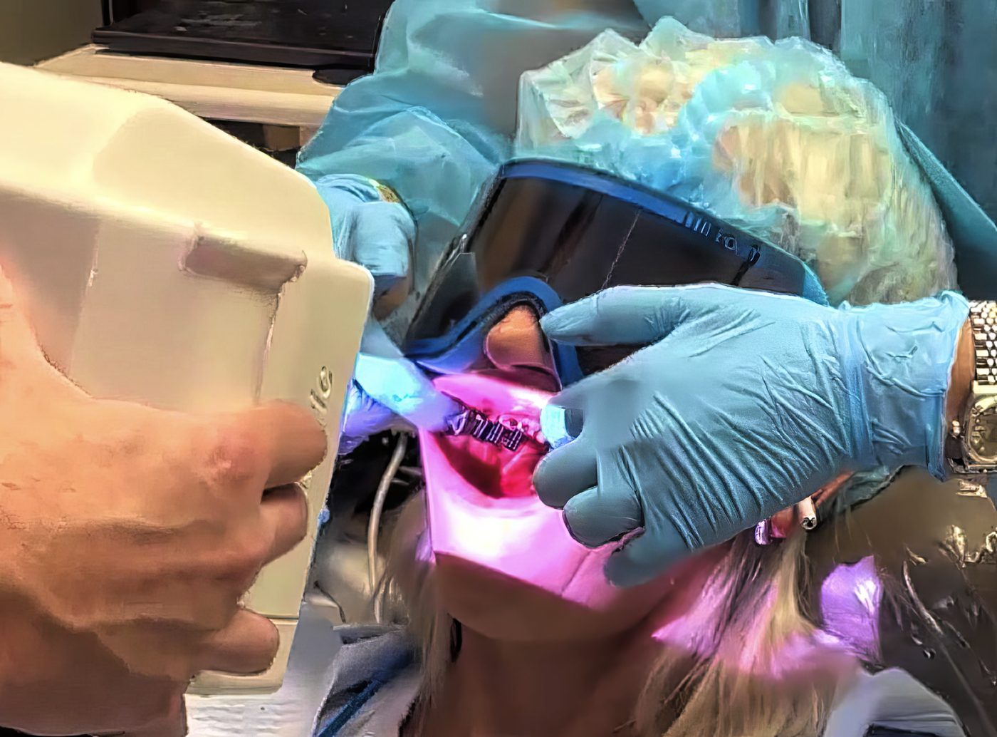 Edentulous Full-Arch Implant Treatment Planning: Evaluating Fixed vs Removable Options - Burbank Dental Lab
