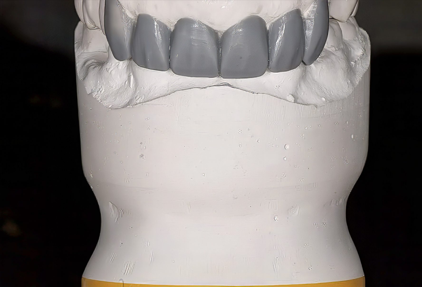 How to Begin a Full-Mouth Rehabilitation: A Case-Based Guide to Esthetics, Function, and Diagnostic Wax-Ups - by Andrew Sedler, COO with Dr. Mark Tyma, DMD