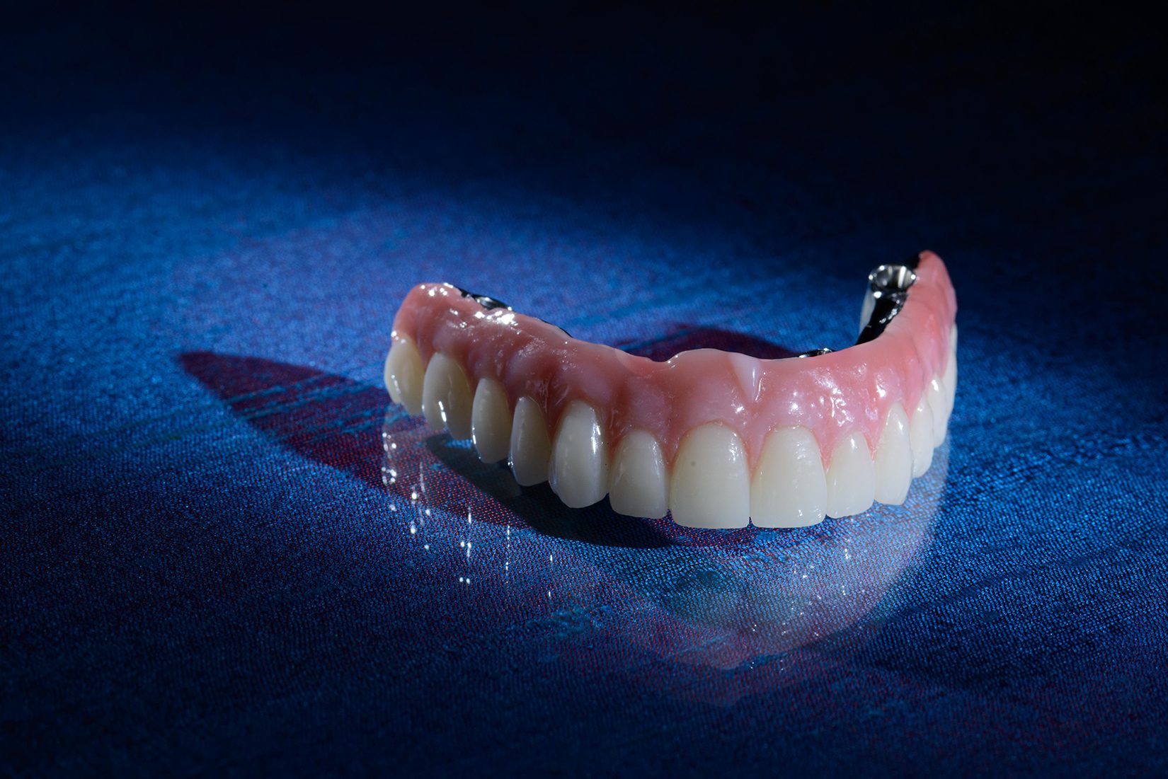 Hybrid Dentures Explained:  Restorative Materials, Framework Design, and Clinical Considerations for Full-Arch Implant Cases - by Andrew Sedler, COO  |  Burbank Dental Lab - CA