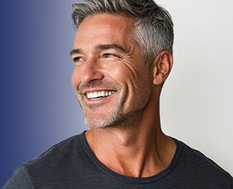 Hybrid Dentures Explained: Restorative Materials, Framework Design, and Clinical Considerations for Full-Arch Implant Cases - Burbank Dental Lab - CA