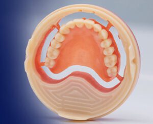Ivoclar Digital Denture Workflow: A Dentist Focused Guide - Burbank Dental Lab - CA