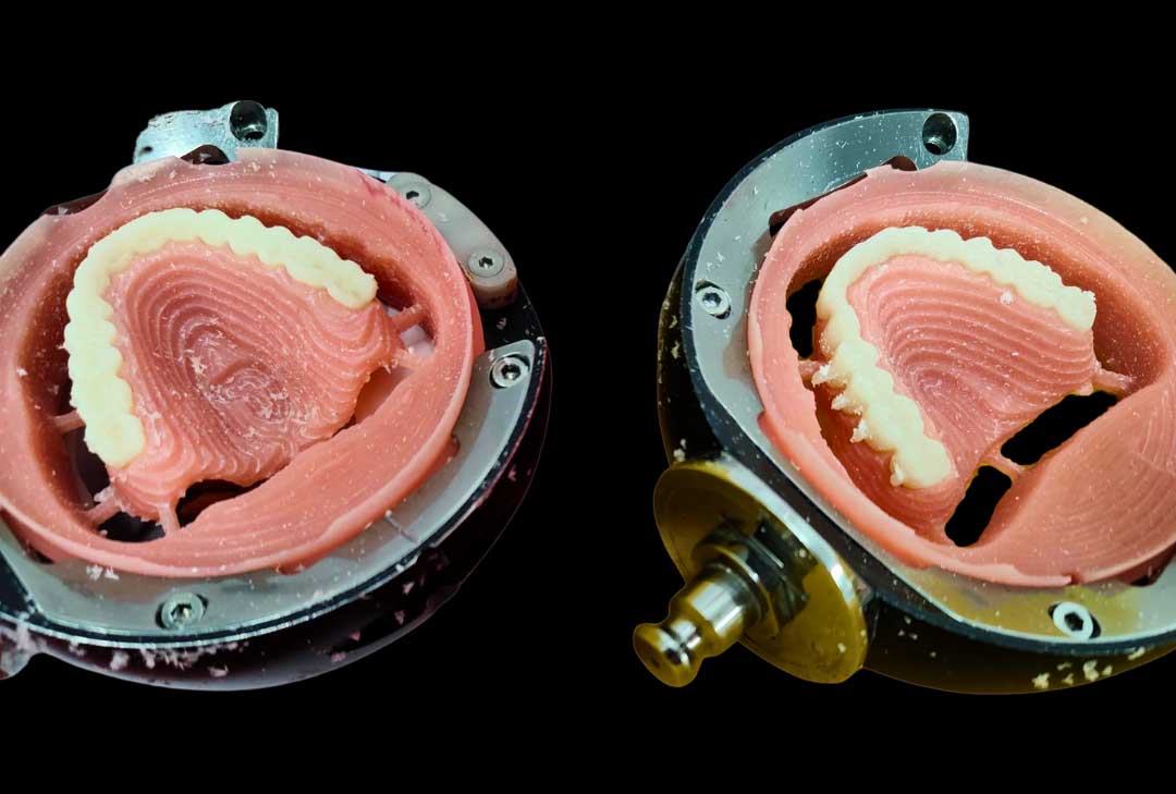 Ivoclar Digital Denture Workflow: A Dentist Focused Guide - Burbank Dental Lab - CA