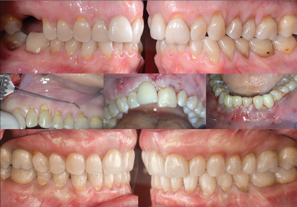 VISTA Institute Course 2025 - Burbank Dental Lab