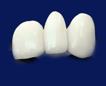 SMART 1 Implant Abutments - Burbank Dental Lab