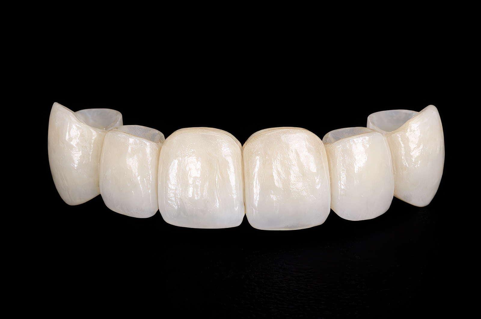 Provisional Restorations as Diagnostic Tools | by Andrew Sedler, COO  |   Burbank Dental Lab