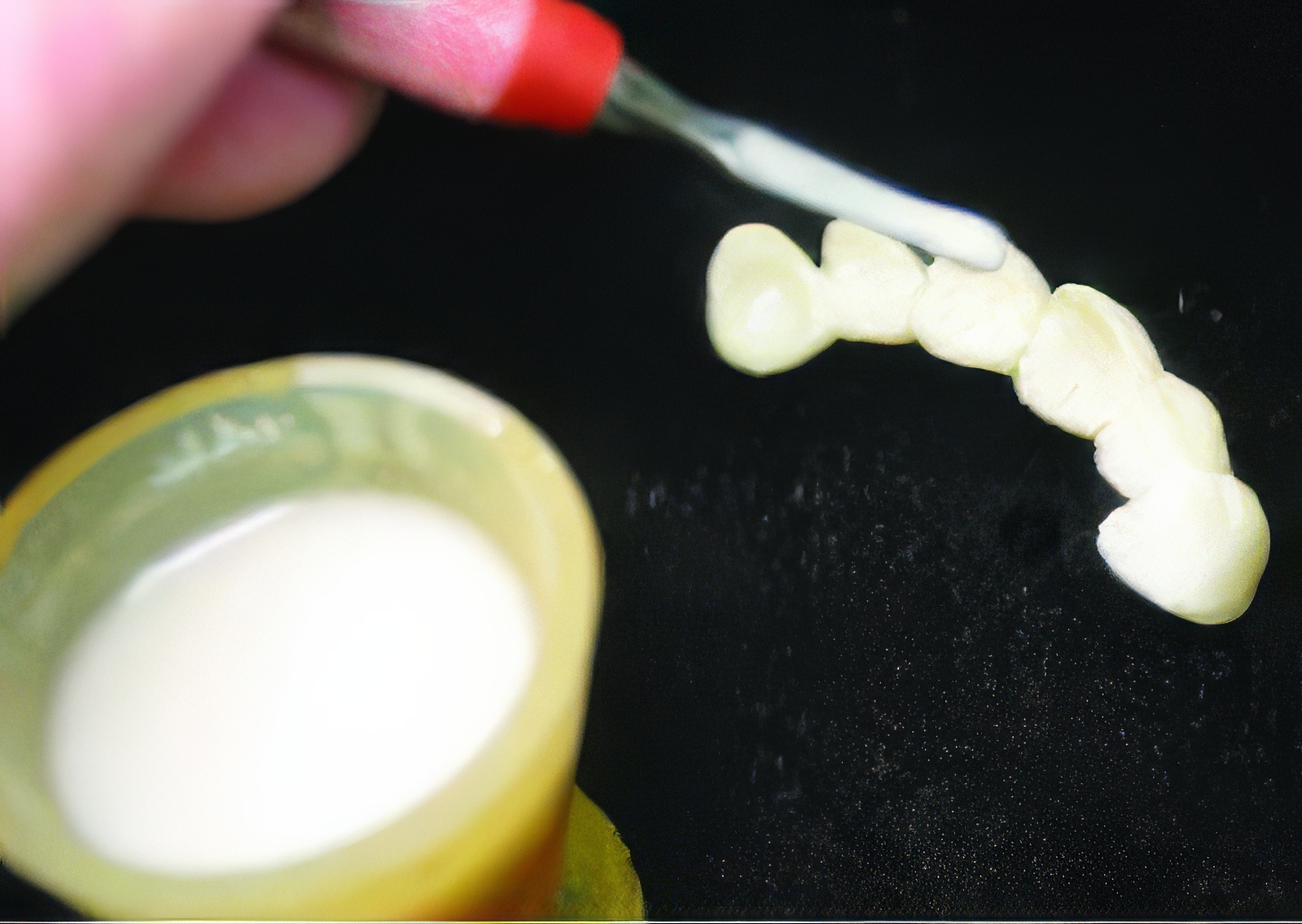 Provisional Restorations as Diagnostic Tools | Burbank Dental Lab