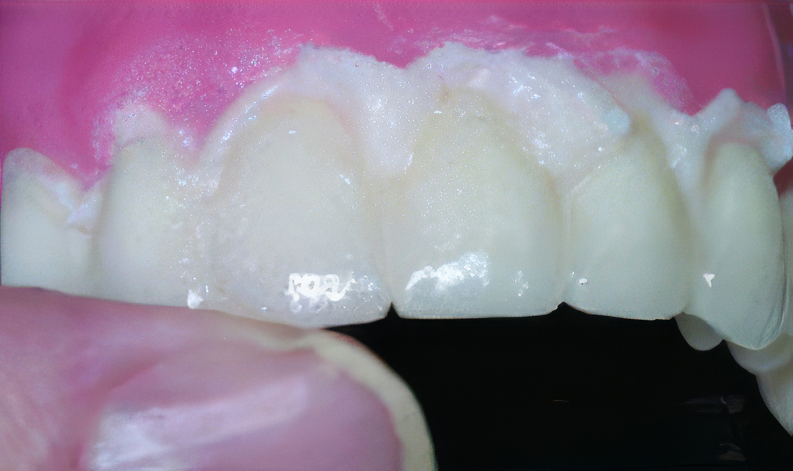 Provisional Restorations as Diagnostic Tools | Burbank Dental Lab
