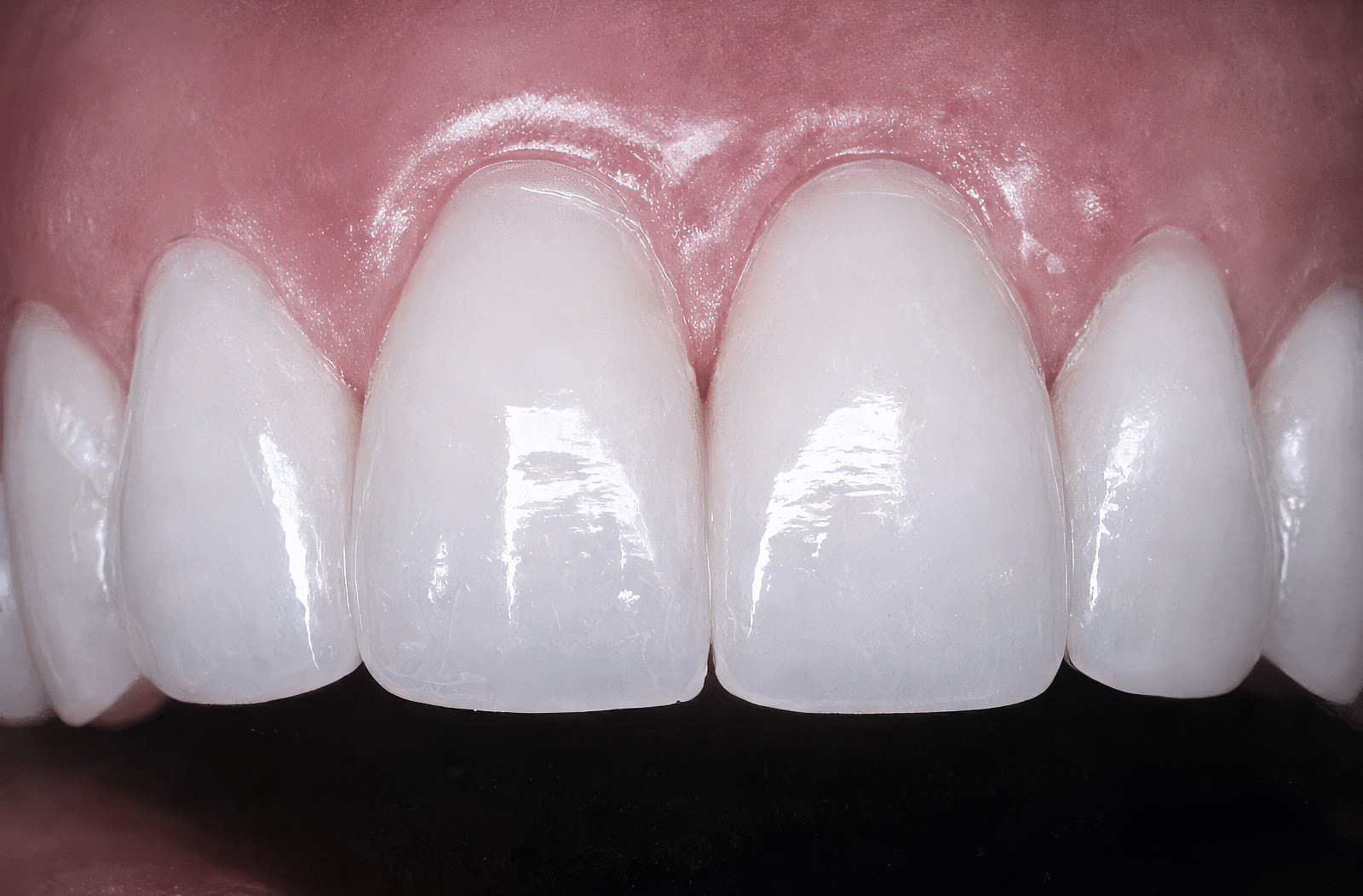 Provisional Restorations as Diagnostic Tools | Burbank Dental Lab