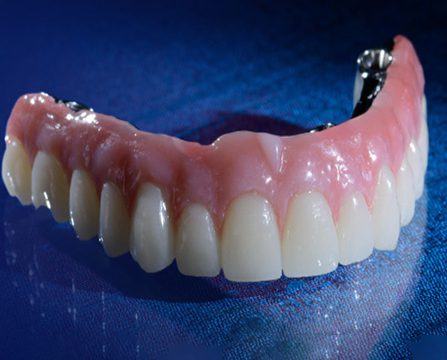 Raising the Bar in Restorative Dentistry: The Latest Innovations in Dental Composites - Burbank Dental Lab